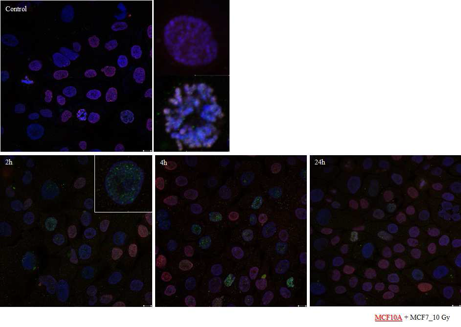방사선 조사 후 공배양 된 정상 세포주 (MCF10A)에서의 bystander effect
