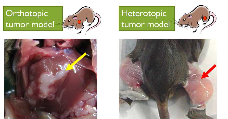 heterotopic 과 orthotopic tumor mouse 모델 및 종양 성장차이