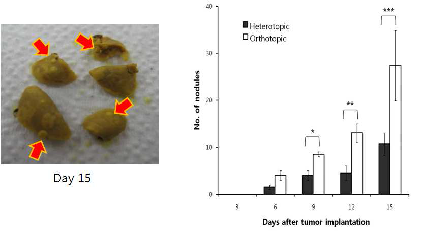 orthotopic 간암 모델 마우 스에서의 폐전이 모습(좌) heterotopic 마우스 모델에서의 전이 nodule 비교 그래프(우)
