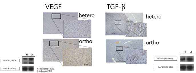 간암 모델 마우스 종양에서의 VEGF / TGF-β 발현양상