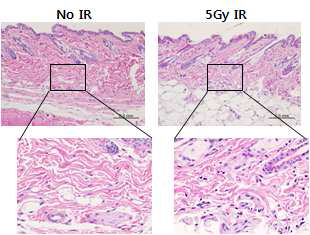 정상조직의 저선량 방사선 조사 후 조직내 변화 양상