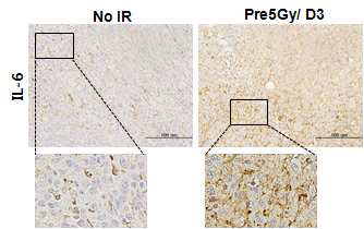 tumor bed에 저 선량의 (5Gy) 방사선을 조사하거나 조사하지 않고 종양을 생성한 마우스의 종양에서의 IL-6 발현량