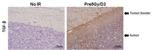 tumor bed에 저 선량의 (5Gy) 방사선을 조사하거나 조사하지 않고 종양을 이식한 마우스의 생성 종양에서의 TGF-β 발현량