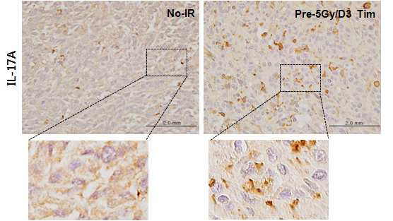 tumor bed에 저 선량의 (5Gy) 방사선을 조사하거나 조사하지 않고 종양을 생성한 마우스의 종양 내 IL-17A의 발현량