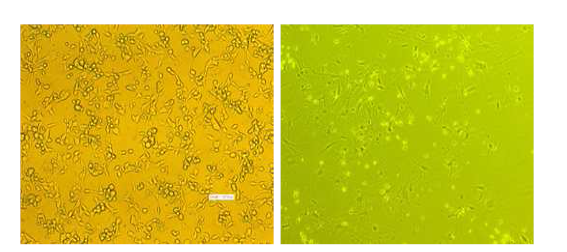 계대배양 시작 직후 종양 내 다양한 세포들이 집합 된 결과 (왼쪽)와 장기간에 걸친 계대 배양을 통해 종양세포만 특이적으로 배양 된 결과 (오른쪽)