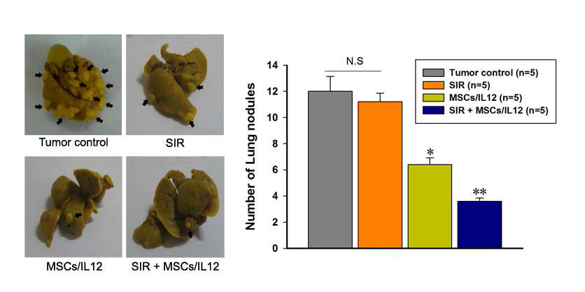 방사선 조사와 유전자 조작 MSCs/IL12의 병행 치료에 의한 폐 전이의 감소. SIR: 10 Gy single irradiation