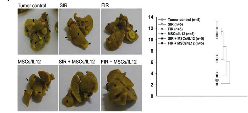 방사선과 MSCs/IL12 병행 치료에 의한 폐전이 감소 효과