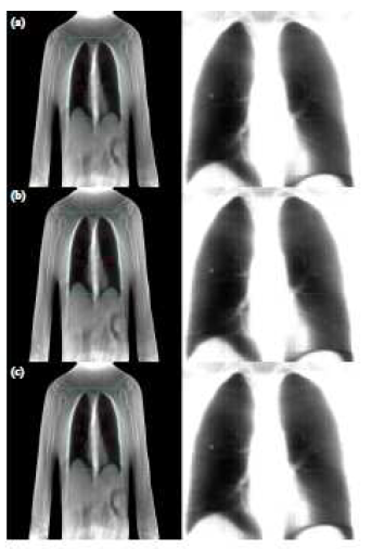 Result of each algorithm image is shown in (a). ML-EM algorithm, (b). OS-EM algorithm and (c.) Hybrid OS-EM algorithm.