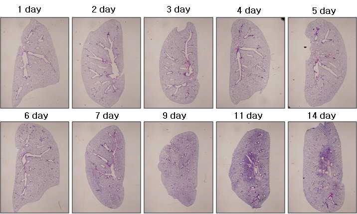 제 4세부과제로 부터 마우스 (C57BL/6, male, 10주령) 폐에 방사선 조사 (Dose 75Gy, Collimator: 3mm)를 받은 조직을 제공받음