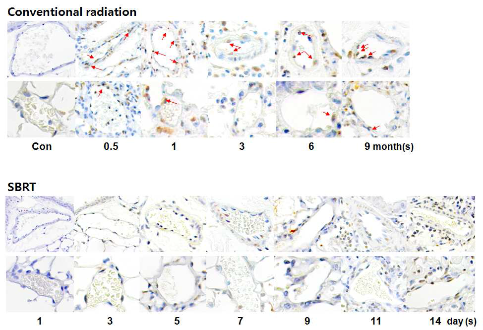 제 4 세부과제로부터 통상적 방사선 조사 (Conventioanl Radiotherapy, 20 Gy)를 받은 마우스의 폐조직과 체부정위 방사선 조사 (SBRT; Stereotactic body radiation therapy, 90 Gy, 3 mm Collimator)를 받은 마우스의 폐조직을 제공받아 TUNEL assay를 수행하여 세포사멸(apoptosis, 짙은 갈색염색)을 관찰.