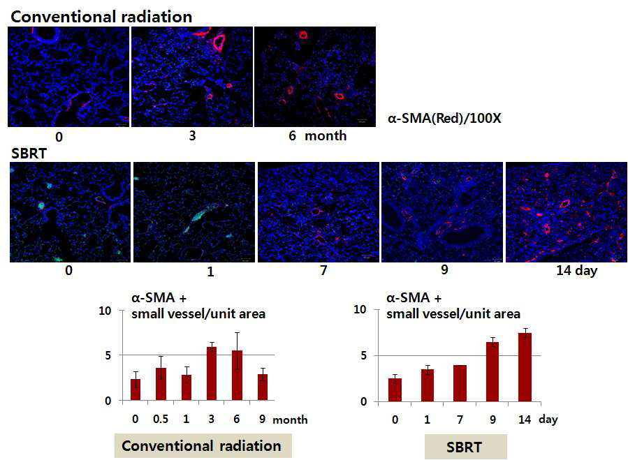 제 4 세부과제로부터 통상적 방사선 조사 (Conventioanl Radiotherapy, 20 Gy)를 받은 마우스의 폐조직과 체부정위 방사선 조사 (SBRT; Stereotactic body radiation therapy, 90 Gy, 3 mm Collimator)를 받은 마우스의 폐조직을 제공받아 α-SMA (Red)와 DAPI (Blue)로 형광 염색하여 관찰한 결과, 방사선 조사 후 α-SMA (Red)가 닫힌 원의 형태로 두텁게 염색되는 것을 통해 소혈관이 형성된 것으로 보임.