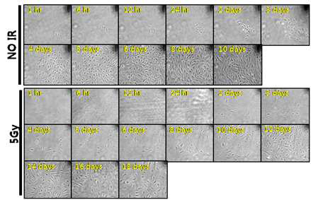 사람 폐의 미세혈관내피세포 (Human Pulmonary Microvascular Endothelial Cells; HPMEC)를 세포 농도가 낮게 배양용기에 부착시킨 후, 방사선을 조사하지 않은 조건과 조사 (5 Gy)한 조건으로 나누어 시간에 따른 세포의 증식과 모양 변화를 현미경을 통해 관찰.