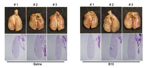 불사화 간엽줄기세포(B10)세포 이식으로 인한 임상 유사 방사선 조사의 폐 섬유화 억제