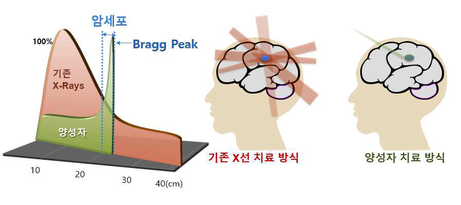 양성자 치료시스템 치료 특성