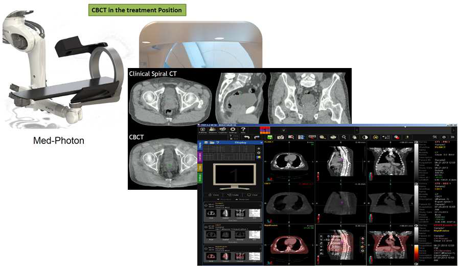 Volumetric Image Registration (CBCT)