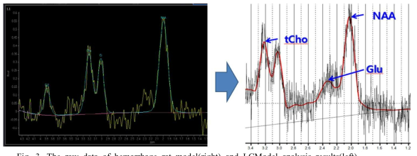 The raw data of hemorrhage rat model(right) and LCModel analysis results(left)