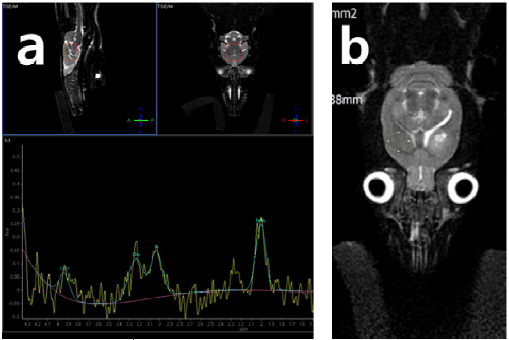 Typical rat brain 1H magnetic resonance spectroscopy of intracerebral hemorrhage (ICH) rat model with voxel (0.8×0.6×0.6 cm3) placement shown in the T2 weighed axial, sagittal and coronal turbo spin images.