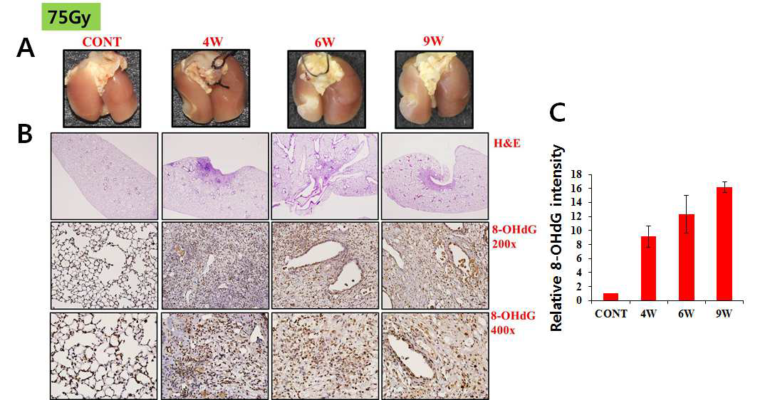 75Gy 방사선 조사된 마우스 폐에서의 산화적 손상 측정.