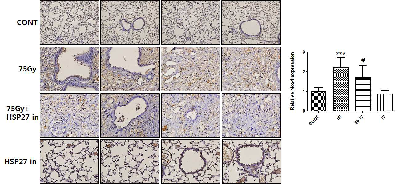 75Gy 방사선 조사된 마우스 폐조직에서 NOX4 면역염색 결과