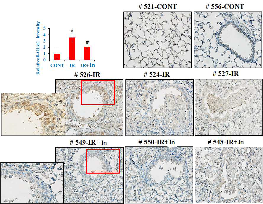 방사선에 의한 산화적 손상에서 hsp27의 산화적 손상 감소 효과. In : hsp27 inhibitor