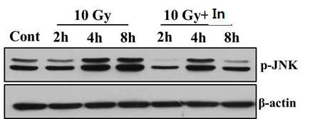 방사선에 의한 JNK활성에서 hsp27 inhibitor의 역할