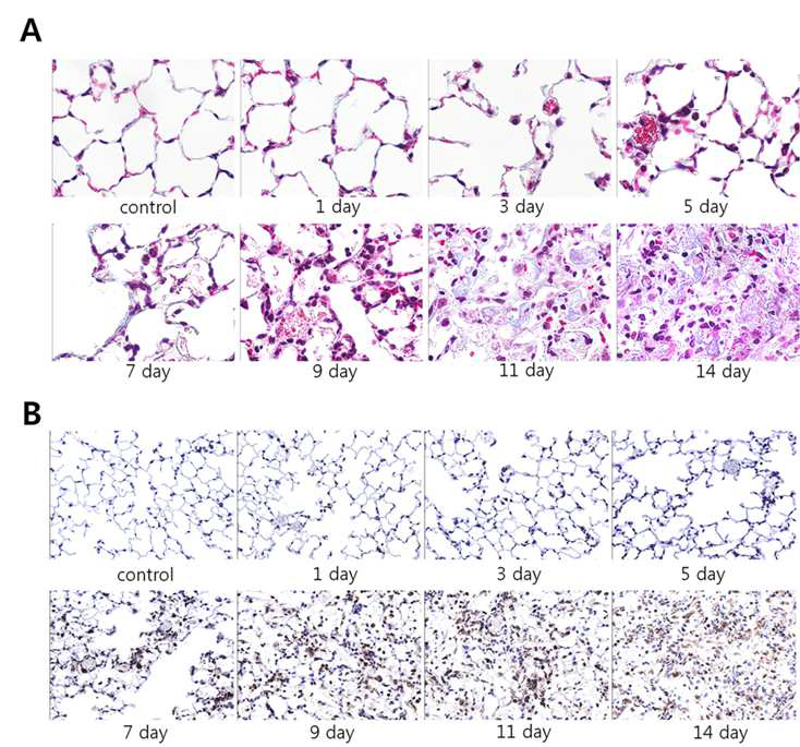 Evaluation of fibrosis