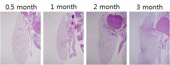 50 Gy 선량으로 마우스 폐에 방사선 조사후 H&E staining