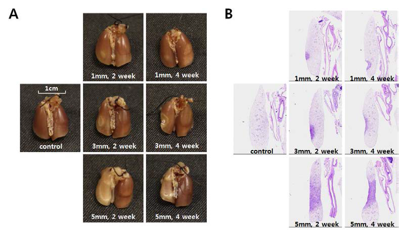 다양한 체적으로 방사선 조사 후 gross morphology와 H&E staining 결과