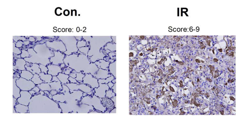 Expression of TGF-b in control and IR-treated groups.