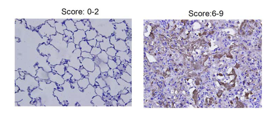 Expression of CD68 in control and IR-treated groups.