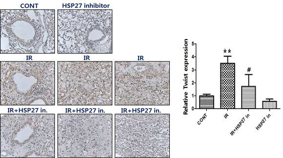 방사선 조사 후 HSP27 inhibitor를 처리한 마우스 폐조직에서 면역염색을 통한 twist 발현확인.