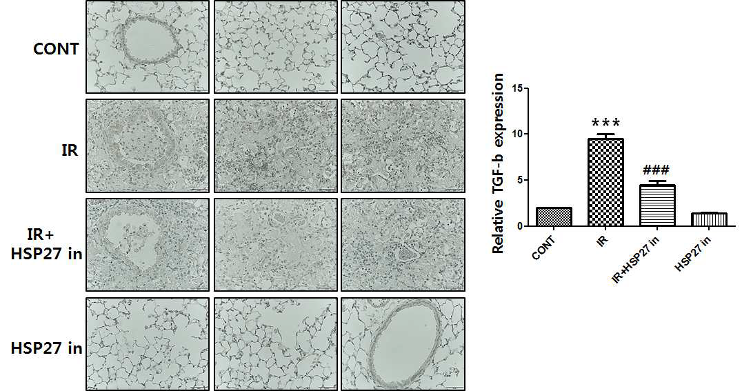 방사선 조사 후 HSP27 inhibitor를 처리한 마우스 폐조직에서 면역염 색을 통한 TGF-b 발현확인.