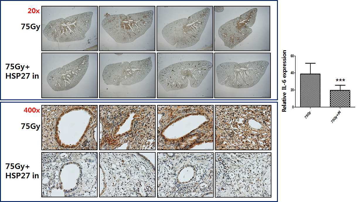 방사선 조사 후 HSP27 inhibitor를 처리한 마우스 폐조직에서 면역염색을 통한 IL-6 발현확인.