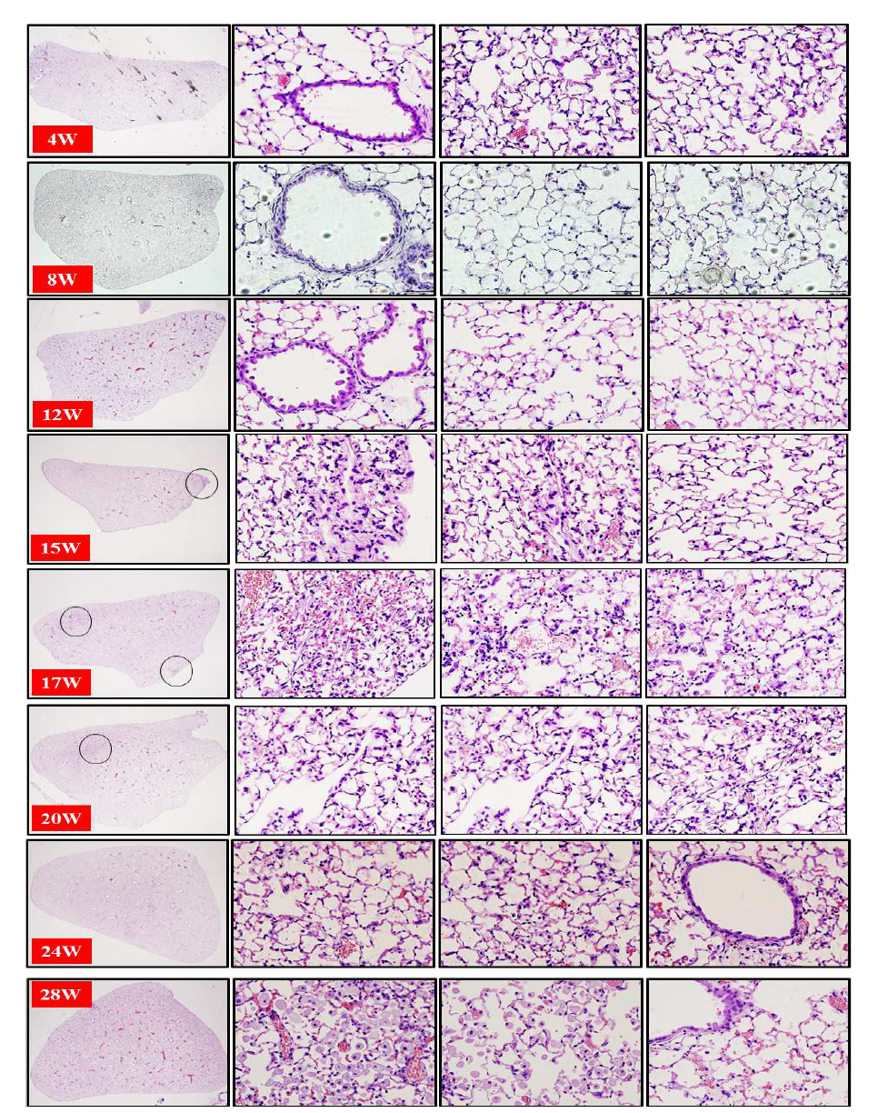 20Gy, left-whole lung에 방사선 조사된 마우스 폐조직에서의 조직학적 변화