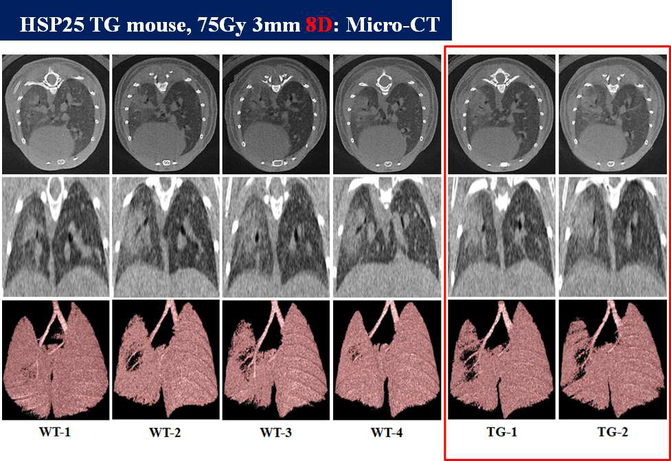 75Gy, 8일간 방사선 조사된 마우스 폐의 micro-CT 촬영을 통 한 폐손상 정도 평가.