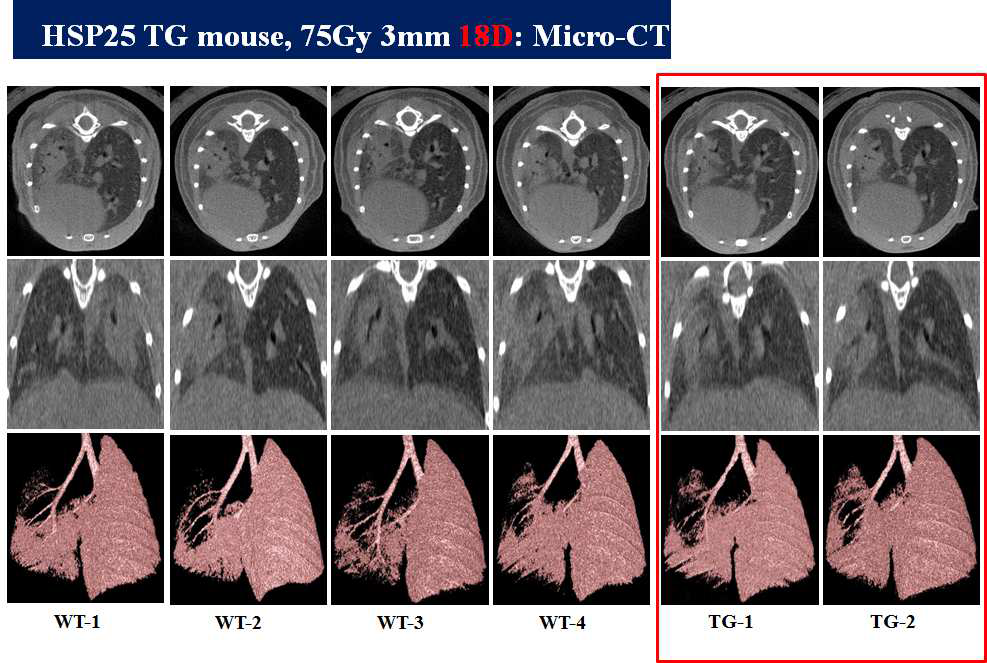 75Gy, 18일간 방사선 조사된 마우스 폐의 micro-CT 촬영을 통한 폐 손상 정도 평가.