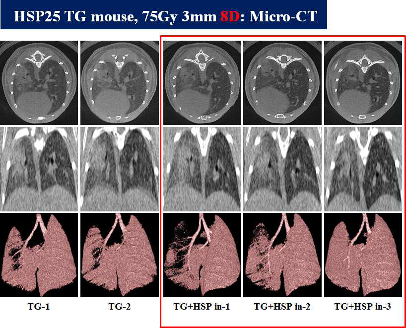 HSP27 inhibitor, 75Gy 8일간 방사선 조사된 마우스 폐의 micro-CT 촬영을 통한 폐손상 정도 평가.