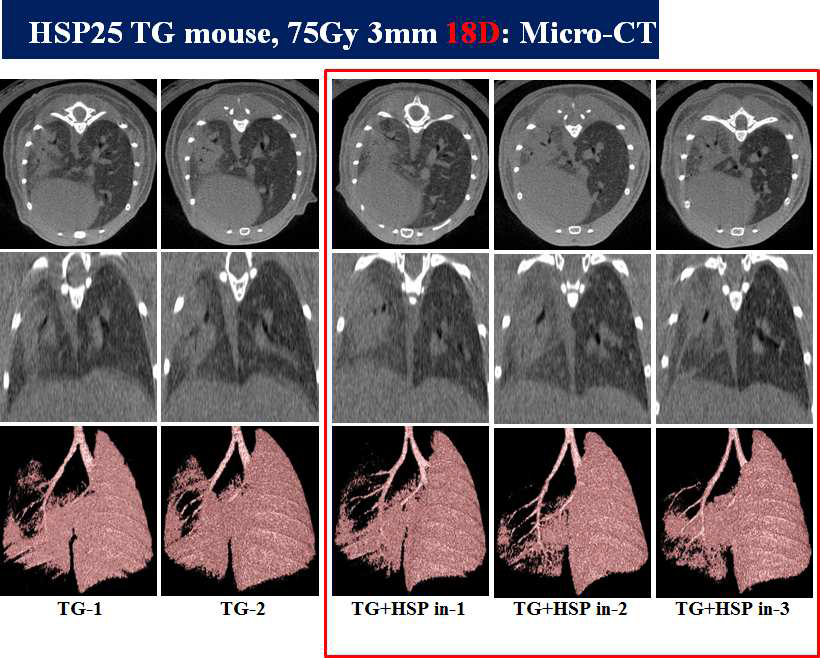 HSP27 inhibitor, 75Gy 18일간 방사선 조사된 마우스 폐의 micro-CT 촬영을 통한 폐손상 정도 평가.