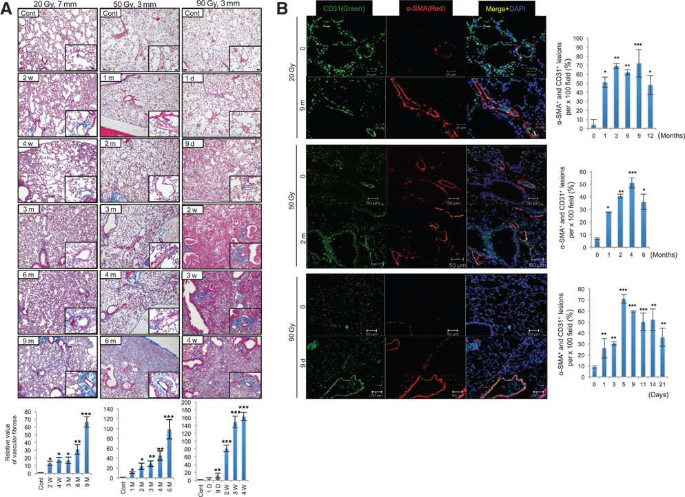 방사선 조사 (20 Gy: 7 mm Collimator, 50 Gy and 90 Gy: 3 mm Collimator)를 받은 마우스의 폐 조직에서 혈관주변의 Trichrome 염색(콜라겐 침착),