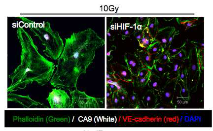 Hypoxia-inducible factor 1-alpha (HIF-1α) 발현을 저해하였을 때, 방사선에 의한 저산소증 마커인 CA9의 발현과 혈관내피세포의 간엽세로포의 전이현상 (EndMT)이 저해되는 것을 확인함.