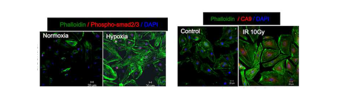 사람의 폐혈관내피세포 (Human Pulmonary Artery Endothelial Cells; HPAEC)은 Hypoxia 처리후 간엽세포 마커인 스트레스 섬유 형성(Phalloidin 염색)과 TGFβ 신호 전달에 관련된 인산화된 Smad2/3 (red)의 발현 변화를 확인함 (왼쪽). 방사선에 의한 폐혈관내피세포에 저산소증 마커인 CA9 (Carbonic anhydrase 9, red)의 발현이 증가되고 스트레스 섬유 형성 (Phalloidin 염색)이 증가되어 있음을 확인함 (오른쪽).