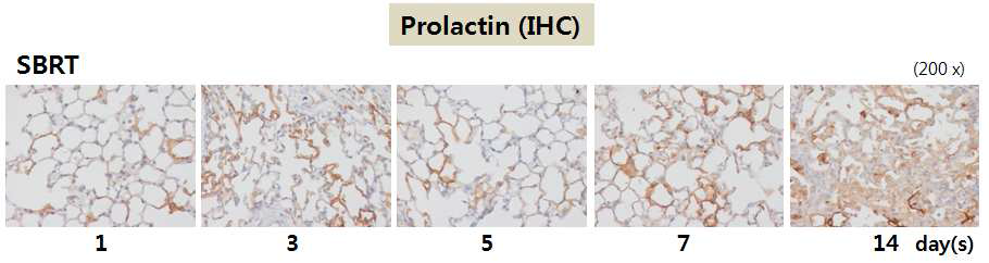 제 4세부과제로부터 체부정위 방사선 조사 (SBRT; Stereotactic body radiation therapy, 90 Gy, 3 mm Collimator)를 받은 마우스의 폐 조직을 제공받아 면역 염색을 수행하여, 방사선에 의한 섬유화 과정 동안 prolactin의 발현 변화 (짙은 갈색)를 관찰함.