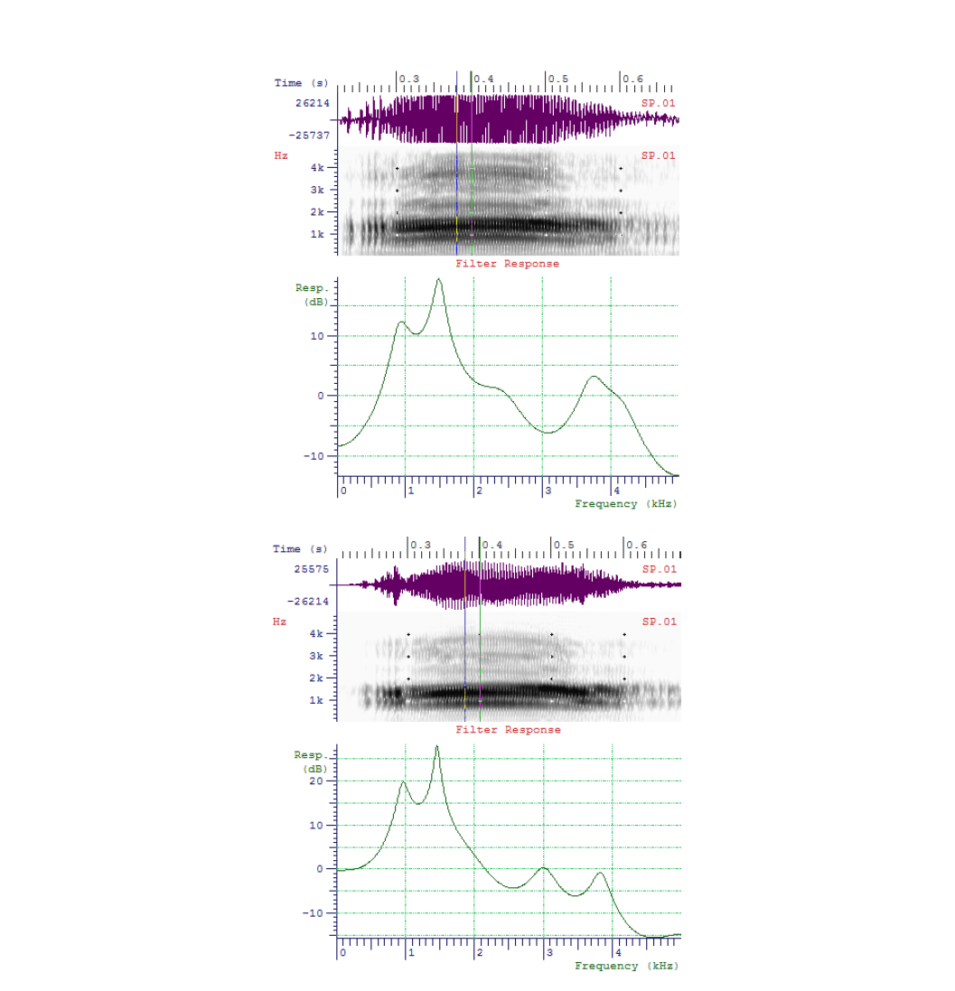 VPI 모음 /a/의 복원전(상), 복원후(하) 시간 주파수 특성