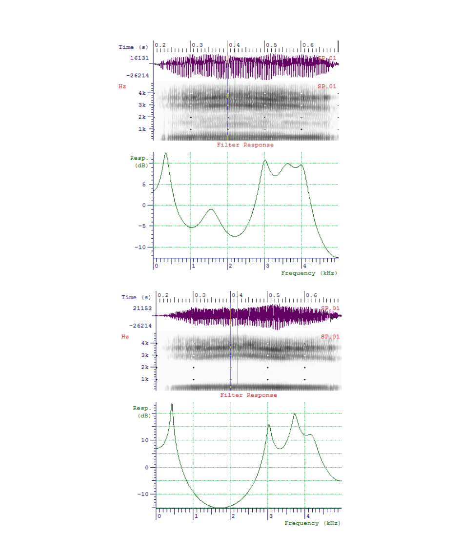 VPI 모음 /i/의 복원전(상), 복원후(하) 시간 주파수 특성