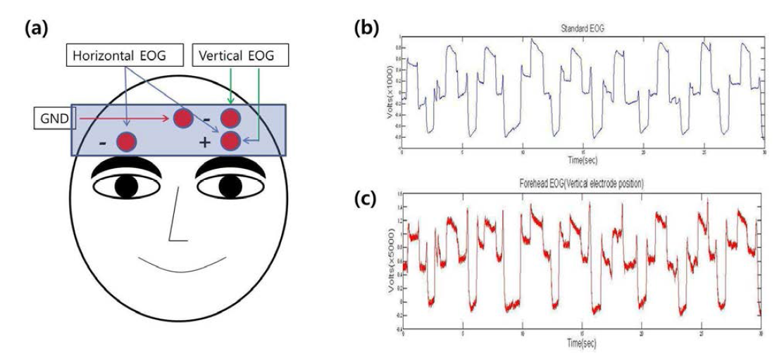(a) 이마 EOG 개념도, 안구가 상하로 움직일 때 (b) 기존 EOG 측정 방식으로 측정한 EOG 신호와 (c) 본 연구에서 제안한 이마 EOG 방식으로 측정한 EOG 신호