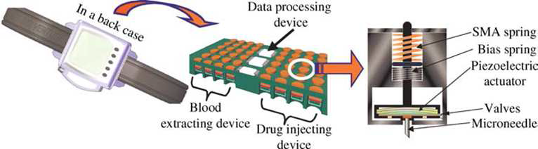 Self Monitoring of Blood Glucose (SMBG)의 개념도.