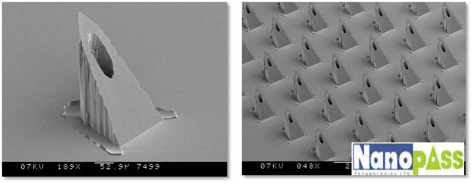 나노패스사의 실리콘 피라미드 마이크로니들.
