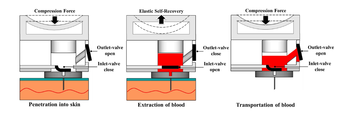 혈액채취 디바이스 작동원리.