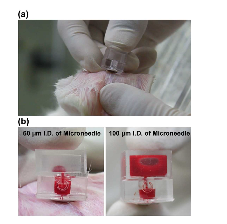 토끼 귀 동맥의 혈액채취 디바이스를 응용; (b) 60 ㎛ 및 100 ㎛ 내경의 마이크로니들을 장착한 디바스의 챔버내에 채취된 혈액 샘플.
