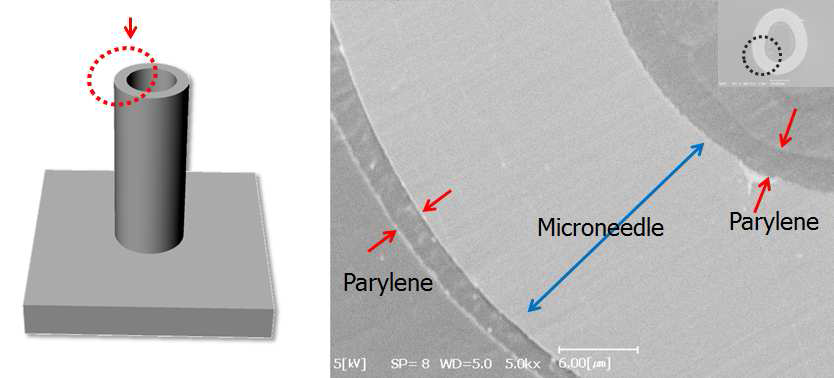 기능성파릴렌 박막이 코팅된 마이크로니들 입구(top-view) SEM이미지. 마SEM이미지는 마이크로니들을 레진에 고정한 후, 마이크로니들의 측면을 폴리싱하고 금박막을 2 μm의 두께로 스퍼터한 후 관찰함.